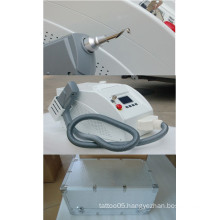 More Effective Tattoo Removal Laser Equipment